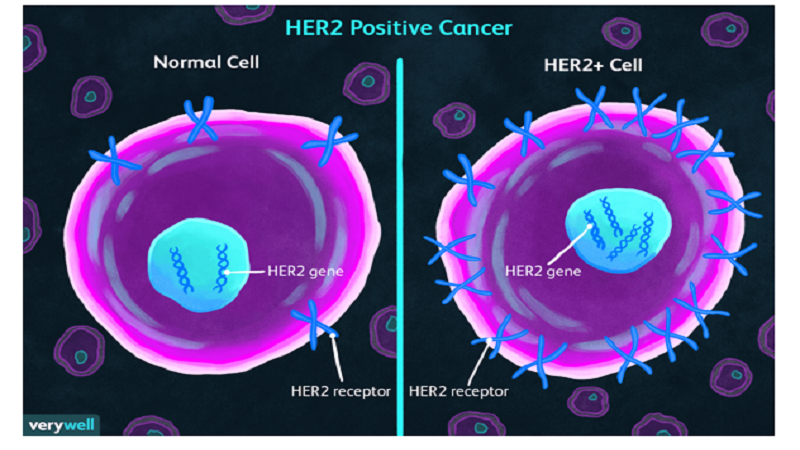 بررسی Her2 در بیماران سرطان سینه | آزمایشگاه ژنتیک اصفهان