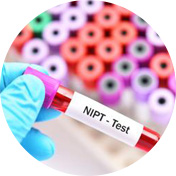 آزمایش ژنتیک جنین (NIPT)