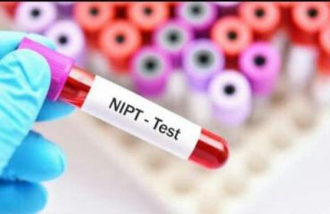 آزمایش NIPT چیست؟