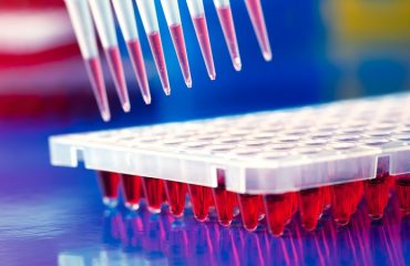 آزمایشگاه ژنتیک اصفهان | آزمایش‌ ژنتیک سرطان برای چه افرادی لازم است ؟ 