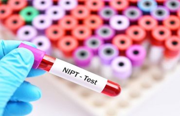 آزمایشگاه ژنتیک اصفهان | شرایط انجام آزمایش NIPT و محدودیت آن