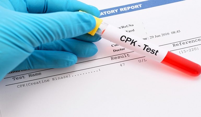 آزمایش کراتین فسفوکیناز (CPK) | آزمایشگاه ژنتیک اصفهان