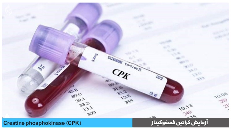 آزمایش کراتین فسفوکیناز (CPK) | آزمایشگاه ژنتیک اصفهان