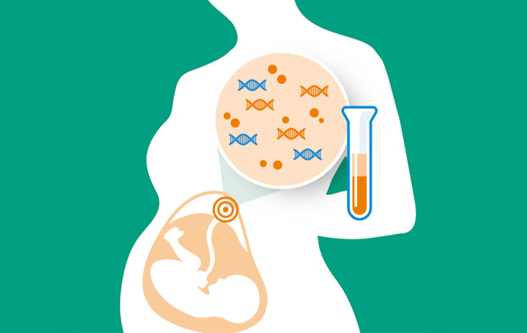 آزمایش سل فری یا تست NIPT، چیستی، تفسیر و احتمال خطا بارداری