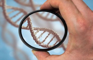 تشخیص سندرم داون با آزمایش ژنتیک