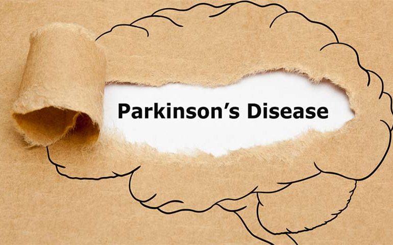 بیماری پارکینسون اختلال مخرب سیستم اعصاب مرکزی