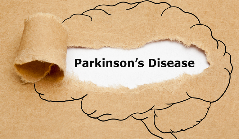 بیماری پارکینسون اختلال مخرب سیستم اعصاب مرکزی